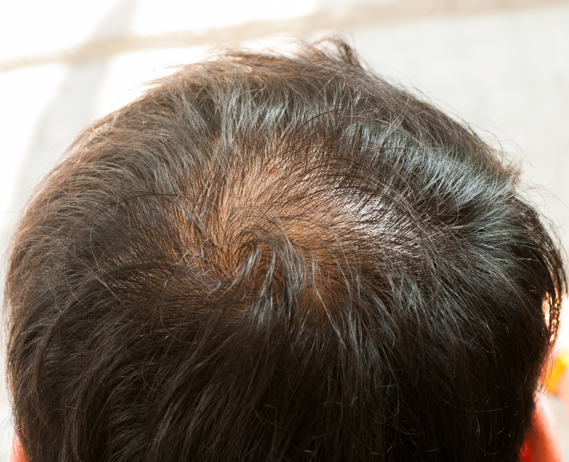 Como hacer crecer el cabello