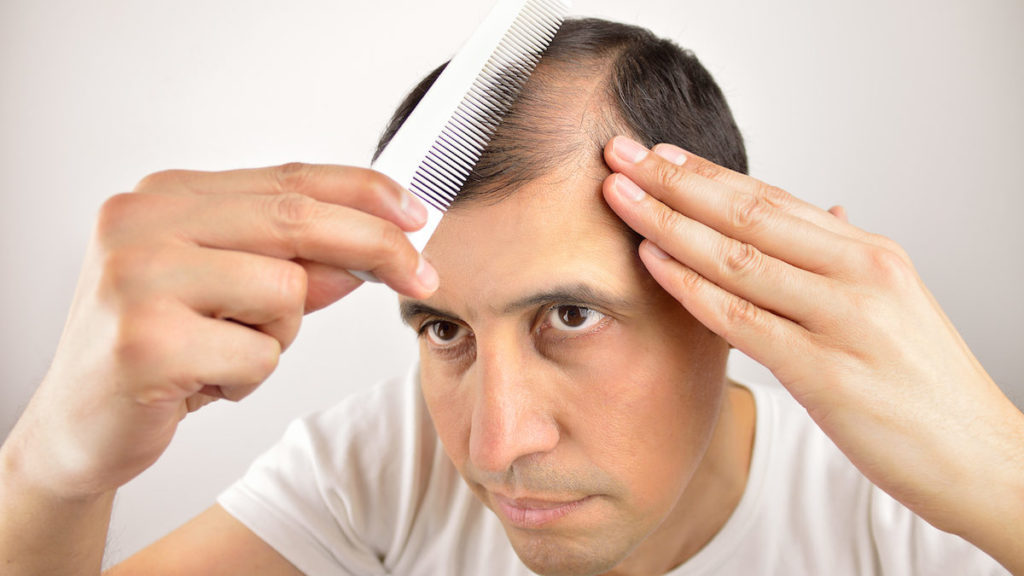 Mejores tratamientos caseros para la caída del cabello