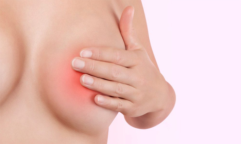 Todo lo que necesitas saber sobre la mastitis